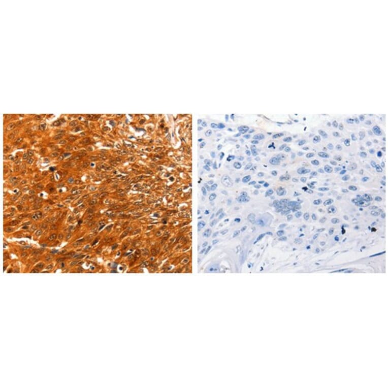 SERPINB5 Antibody from Signalway Antibody (31098) - Antibodies.com