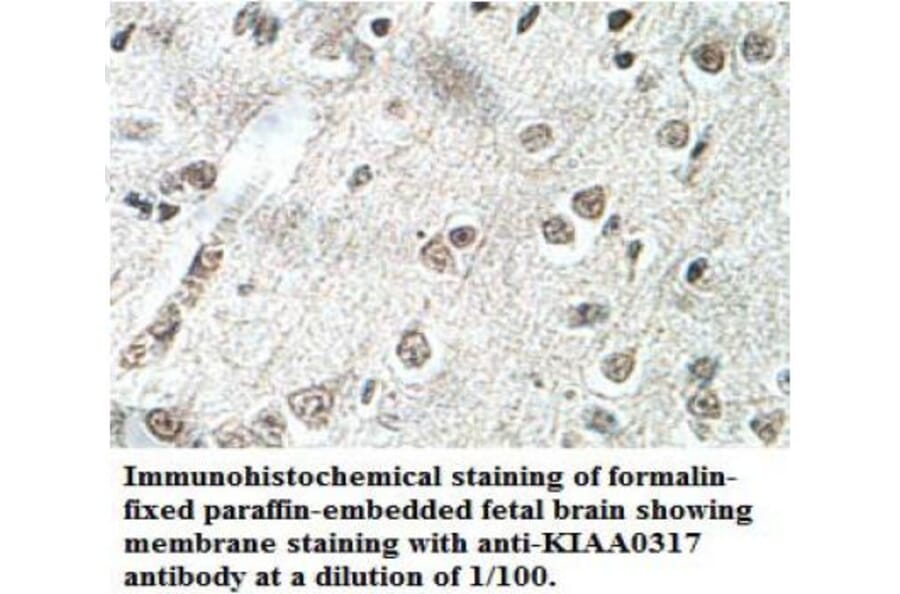 KIAA0317 Antibody from Signalway Antibody (39699) - Antibodies.com