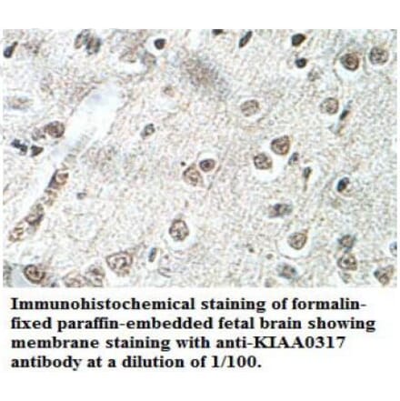KIAA0317 Antibody from Signalway Antibody (39699) - Antibodies.com