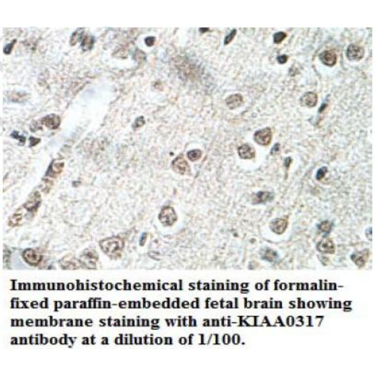 KIAA0317 Antibody from Signalway Antibody (39699) - Antibodies.com