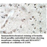 KIAA0317 Antibody from Signalway Antibody (39699) - Antibodies.com
