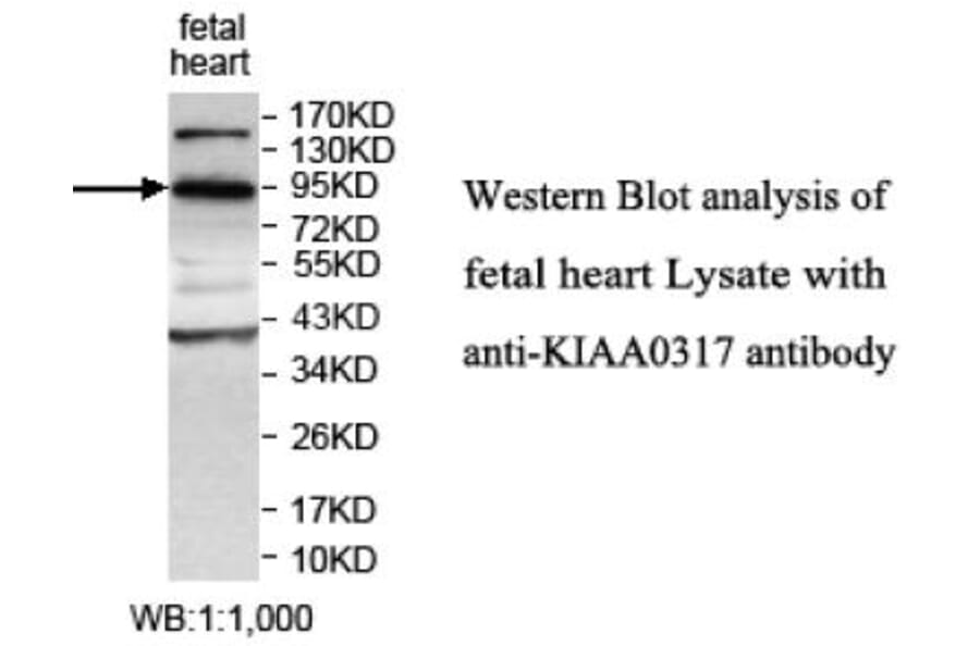 KIAA0317 Antibody from Signalway Antibody (39699) - Antibodies.com