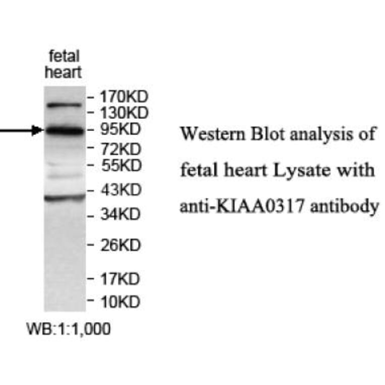 KIAA0317 Antibody from Signalway Antibody (39699) - Antibodies.com