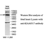 KIAA0317 Antibody from Signalway Antibody (39699) - Antibodies.com