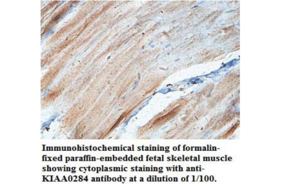KIAA0284 Antibody from Signalway Antibody (39700) - Antibodies.com