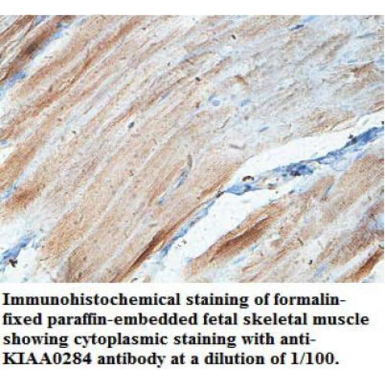KIAA0284 Antibody from Signalway Antibody (39700) - Antibodies.com