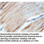KIAA0284 Antibody from Signalway Antibody (39700) - Antibodies.com