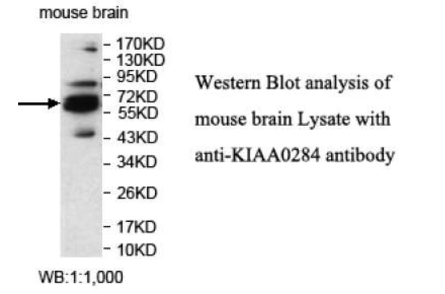 KIAA0284 Antibody from Signalway Antibody (39700) - Antibodies.com