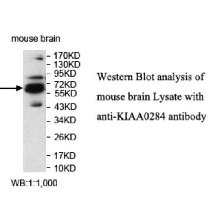 KIAA0284 Antibody from Signalway Antibody (39700) - Antibodies.com