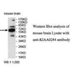KIAA0284 Antibody from Signalway Antibody (39700) - Antibodies.com