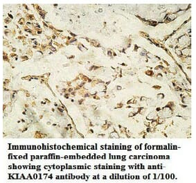 KIAA0174 Antibody from Signalway Antibody (39746) - Antibodies.com