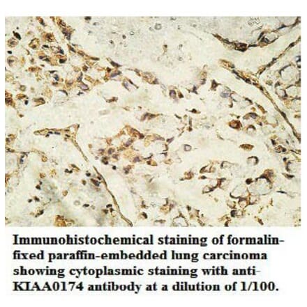 KIAA0174 Antibody from Signalway Antibody (39746) - Antibodies.com
