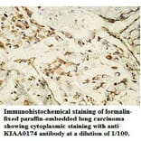 KIAA0174 Antibody from Signalway Antibody (39746) - Antibodies.com