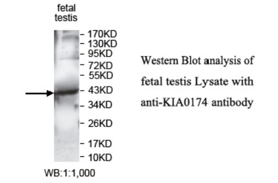 KIAA0174 Antibody from Signalway Antibody (39746) - Antibodies.com