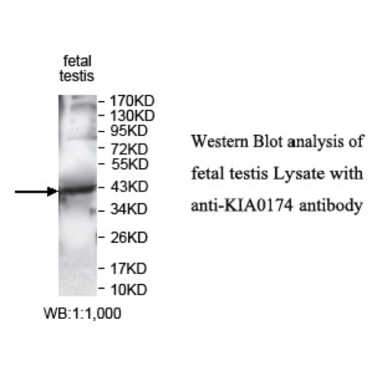 KIAA0174 Antibody from Signalway Antibody (39746) - Antibodies.com