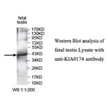 KIAA0174 Antibody from Signalway Antibody (39746) - Antibodies.com