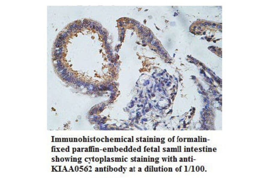 KIAA0562 Antibody from Signalway Antibody (39764) - Antibodies.com