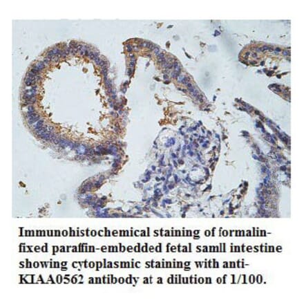 KIAA0562 Antibody from Signalway Antibody (39764) - Antibodies.com