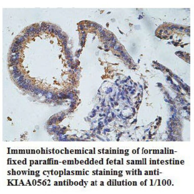 KIAA0562 Antibody from Signalway Antibody (39764) - Antibodies.com