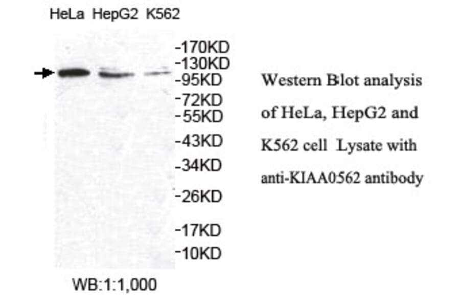 KIAA0562 Antibody from Signalway Antibody (39764) - Antibodies.com