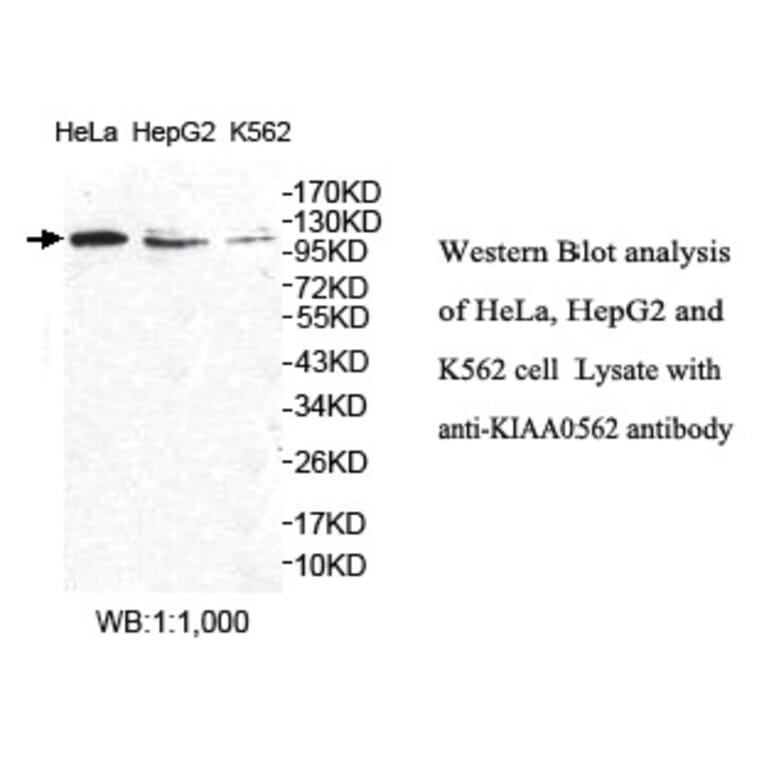 KIAA0562 Antibody from Signalway Antibody (39764) - Antibodies.com