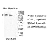 KIAA0562 Antibody from Signalway Antibody (39764) - Antibodies.com