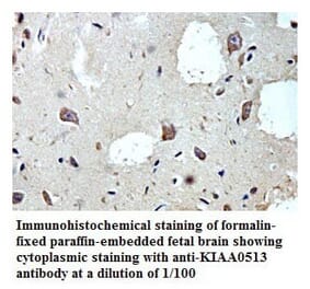 KIAA0513 Antibody from Signalway Antibody (39784) - Antibodies.com