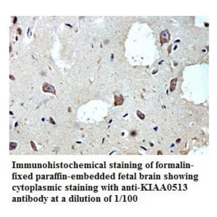 KIAA0513 Antibody from Signalway Antibody (39784) - Antibodies.com