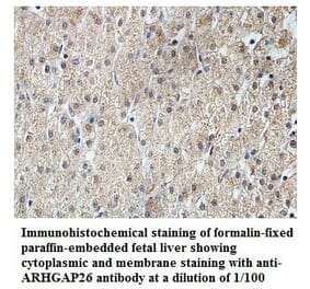 ARHGAP26 Antibody from Signalway Antibody (39830) - Antibodies.com