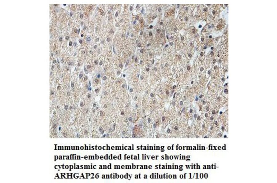 ARHGAP26 Antibody from Signalway Antibody (39830) - Antibodies.com