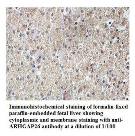 ARHGAP26 Antibody from Signalway Antibody (39830) - Antibodies.com