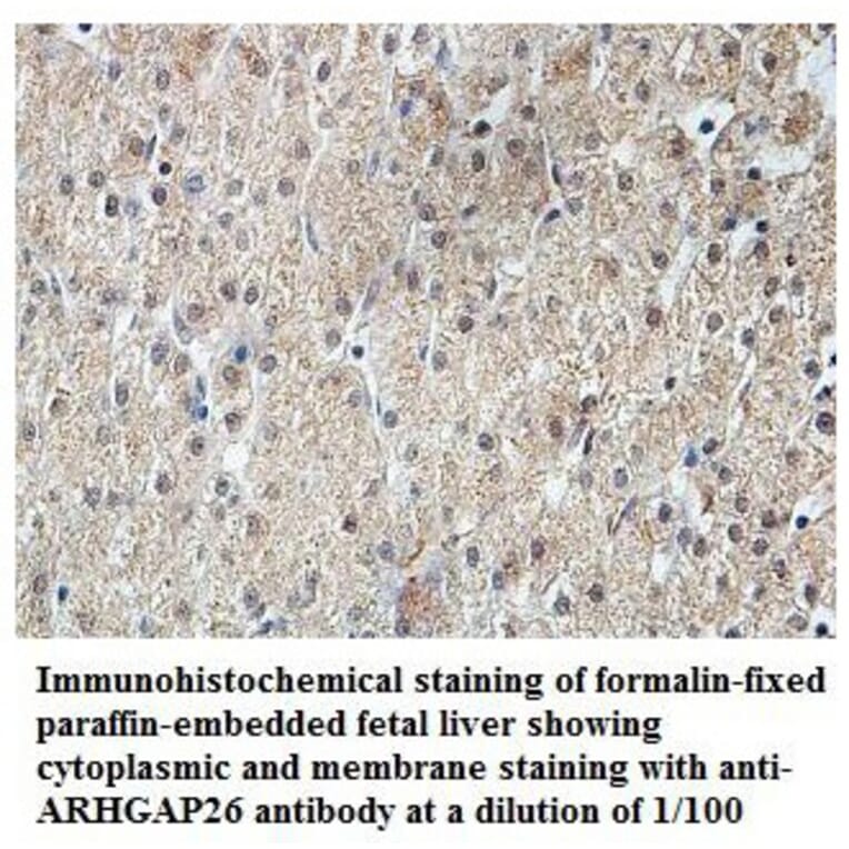 ARHGAP26 Antibody from Signalway Antibody (39830) - Antibodies.com