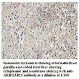 ARHGAP26 Antibody from Signalway Antibody (39830) - Antibodies.com