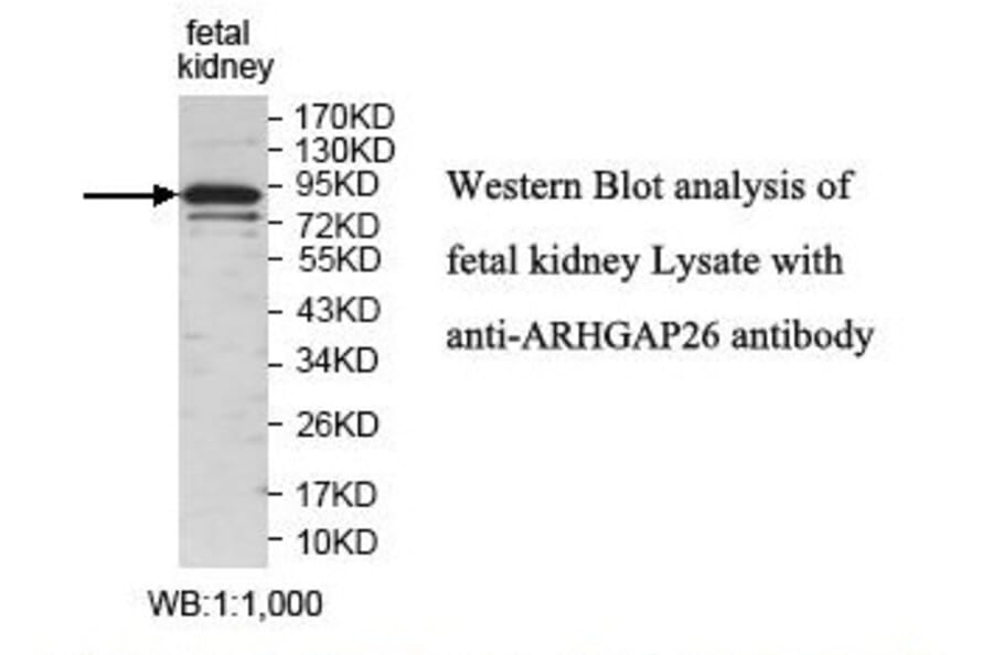 ARHGAP26 Antibody from Signalway Antibody (39830) - Antibodies.com