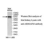 ARHGAP26 Antibody from Signalway Antibody (39830) - Antibodies.com