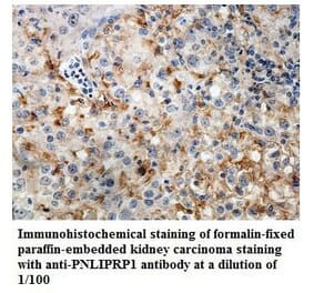 PNLIPRP1 Antibody from Signalway Antibody (39841) - Antibodies.com