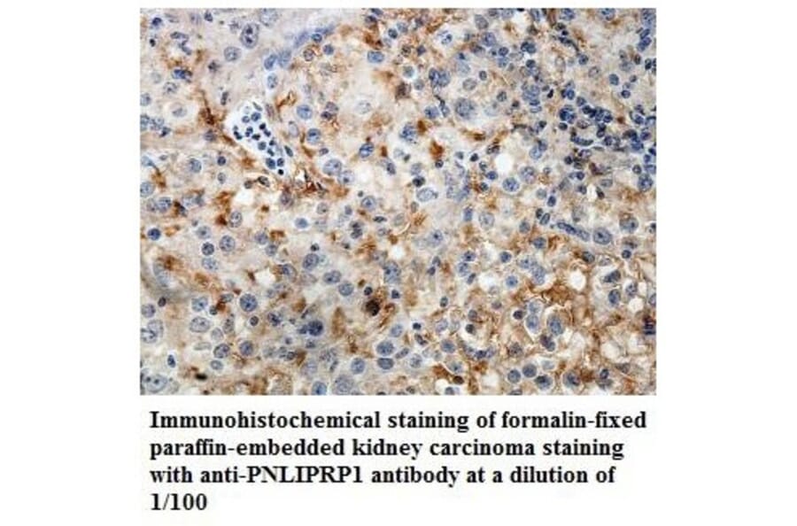 PNLIPRP1 Antibody from Signalway Antibody (39841) - Antibodies.com