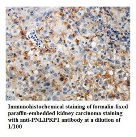 PNLIPRP1 Antibody from Signalway Antibody (39841) - Antibodies.com