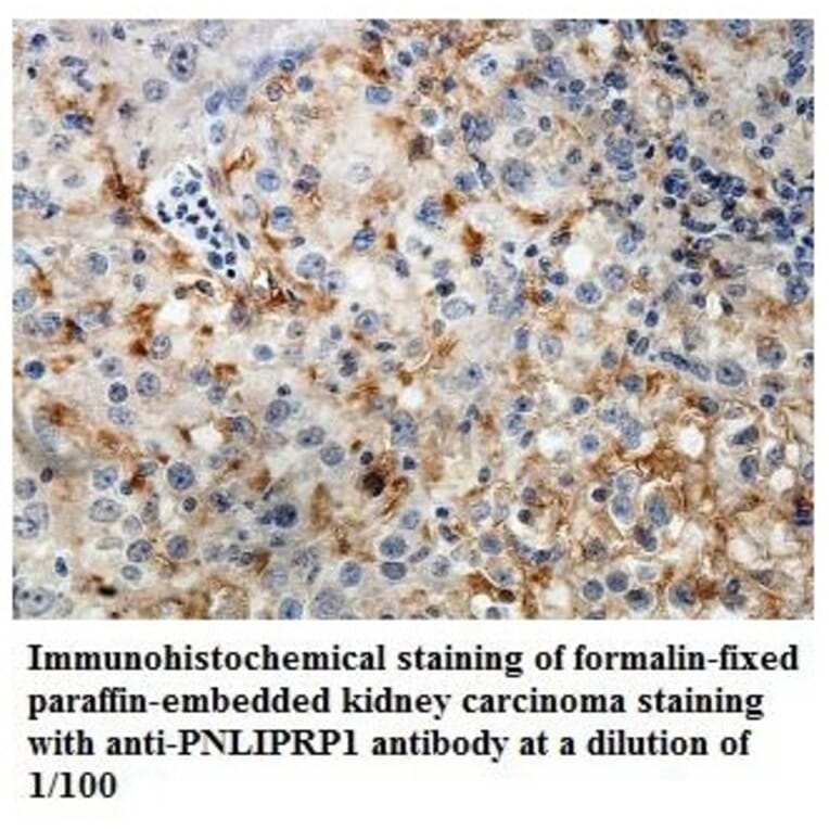 PNLIPRP1 Antibody from Signalway Antibody (39841) - Antibodies.com