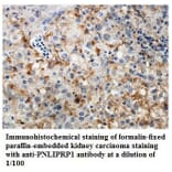 PNLIPRP1 Antibody from Signalway Antibody (39841) - Antibodies.com