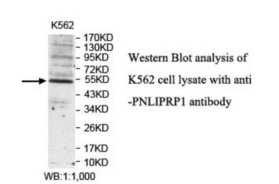 PNLIPRP1 Antibody from Signalway Antibody (39841) - Antibodies.com