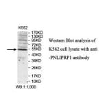 PNLIPRP1 Antibody from Signalway Antibody (39841) - Antibodies.com