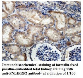 PNLIPRP2 Antibody from Signalway Antibody (39842) - Antibodies.com