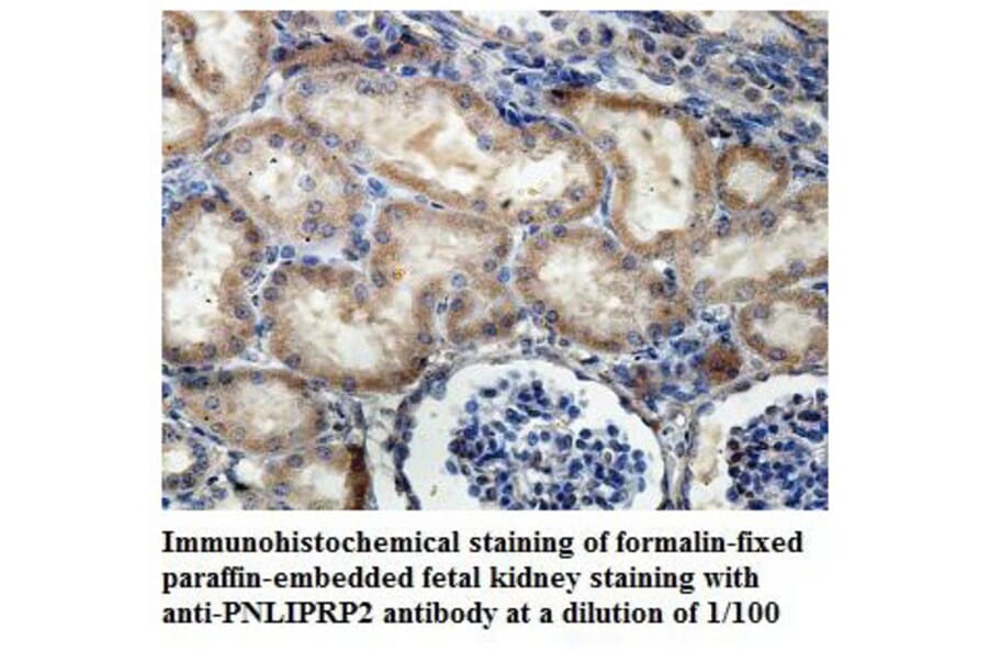PNLIPRP2 Antibody from Signalway Antibody (39842) - Antibodies.com