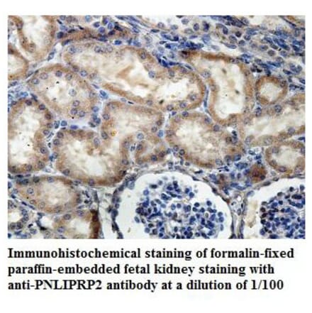 PNLIPRP2 Antibody from Signalway Antibody (39842) - Antibodies.com