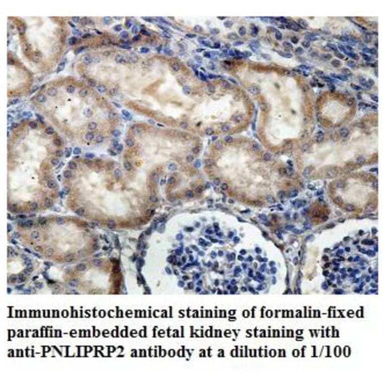 PNLIPRP2 Antibody from Signalway Antibody (39842) - Antibodies.com
