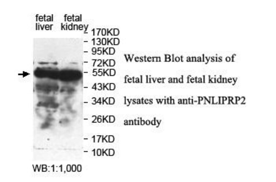 PNLIPRP2 Antibody from Signalway Antibody (39842) - Antibodies.com