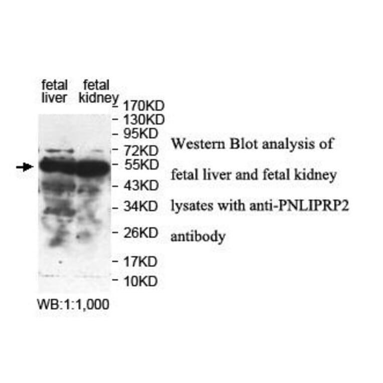 PNLIPRP2 Antibody from Signalway Antibody (39842) - Antibodies.com