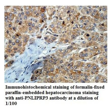 PNLIPRP3 Antibody from Signalway Antibody (39843) - Antibodies.com