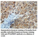PNLIPRP3 Antibody from Signalway Antibody (39843) - Antibodies.com